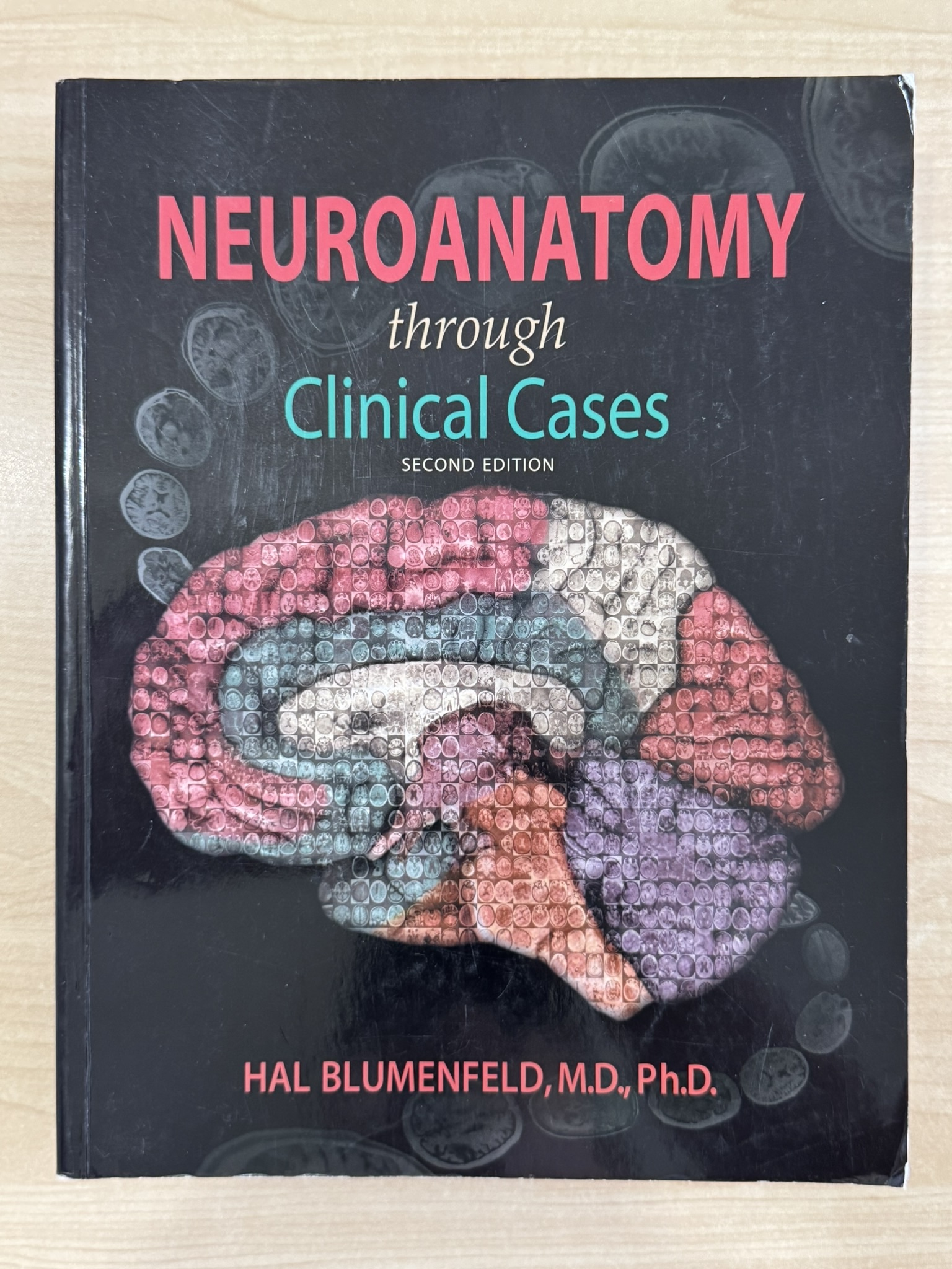 Neuroanatomy Through Clinical Cases
